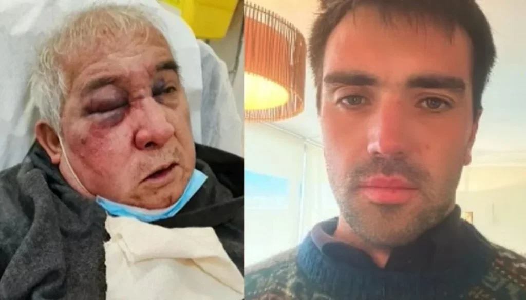 Impactante Agresión a Conserje Deja Secuelas Graves en Vitacura