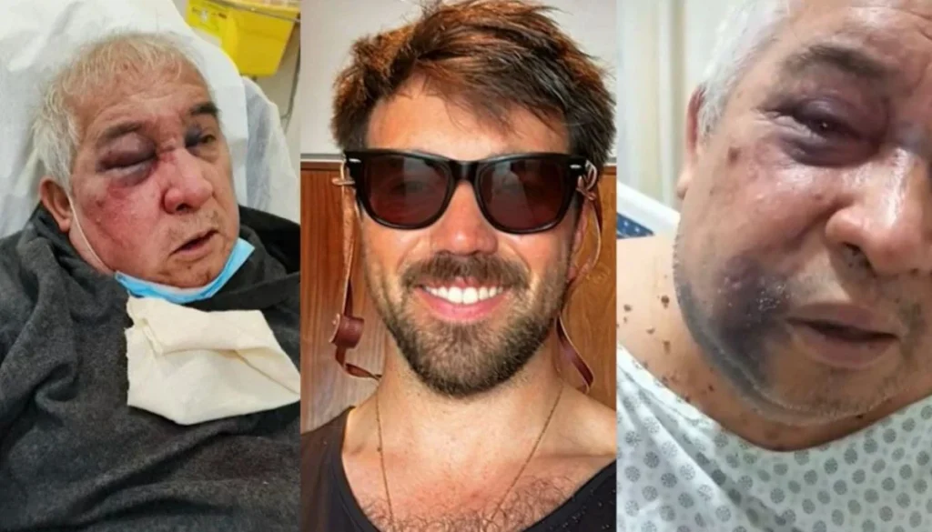 Conserje de Vitacura Queda al Borde de la Ceguera tras Agresión