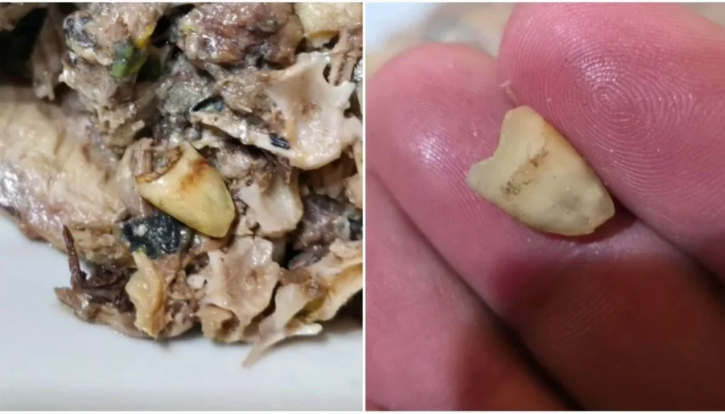 Hallazgo Impactante: Encuentran Diente en Lata de Jurel San José