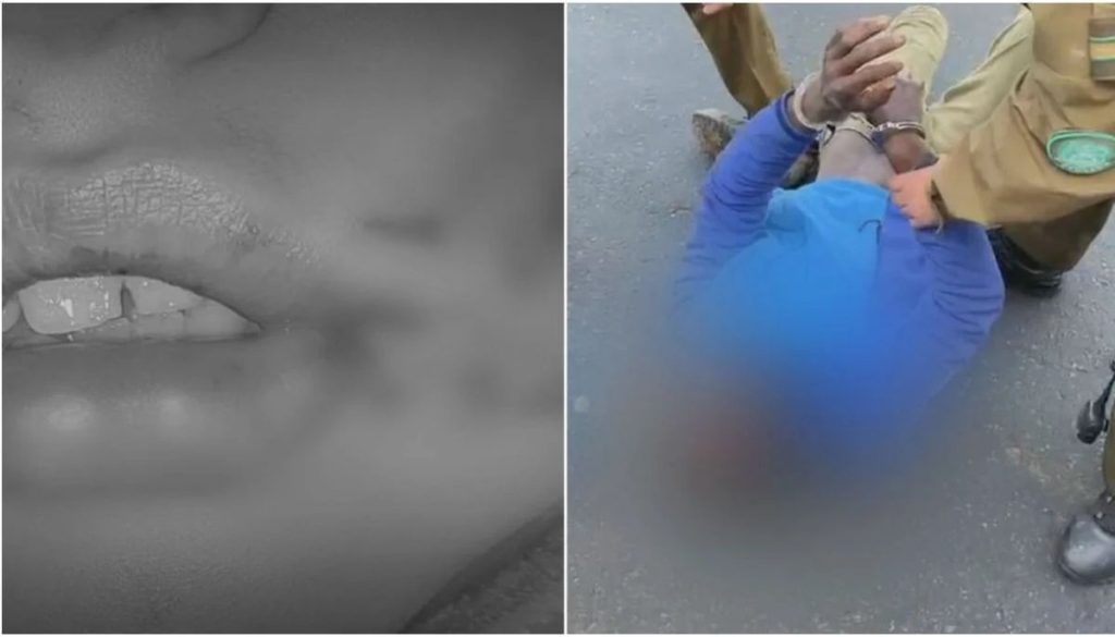 Impactante Ataque a Niño en Biobío Desata Alarma y Reacciones