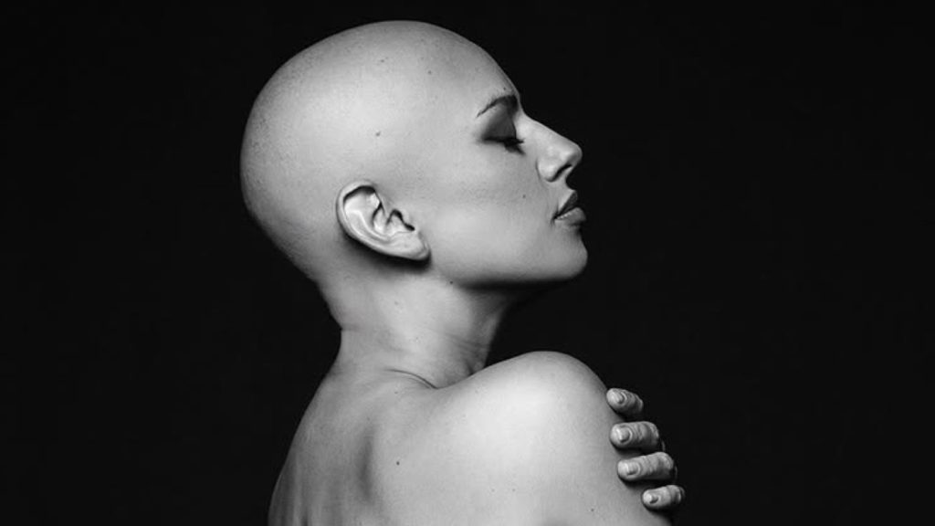 Karla Melo inspira con potente mensaje tras seis quimioterapias.