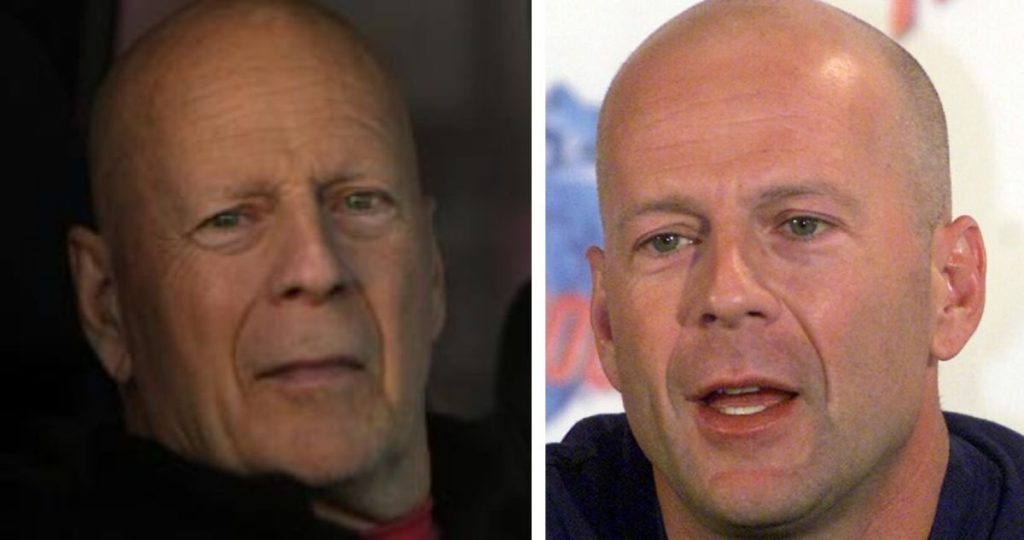 La salud de Bruce Willis: Desafíos y revelaciones actuales sobre su estado