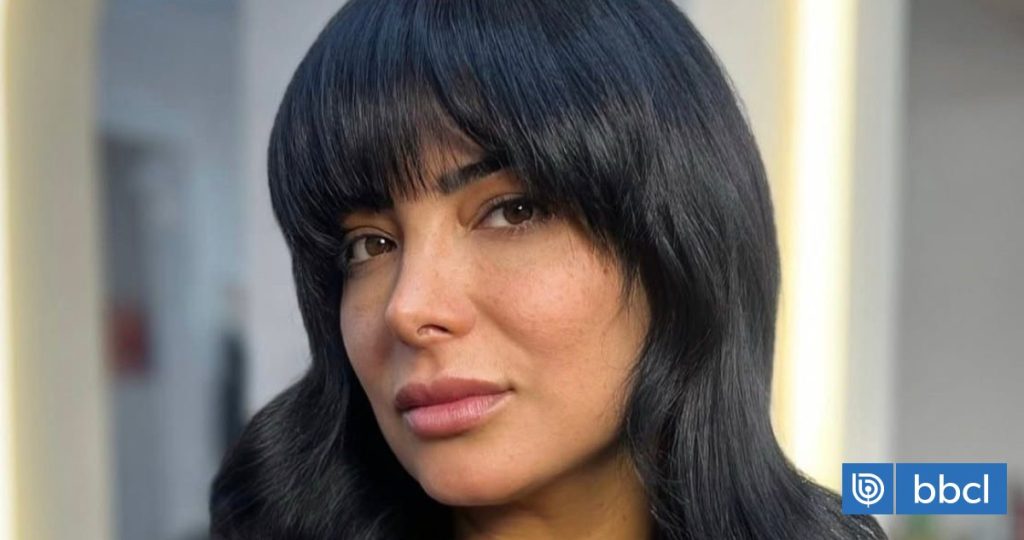 Hijo de Mariela Montero es sometido a cirugía tras ataque de perro