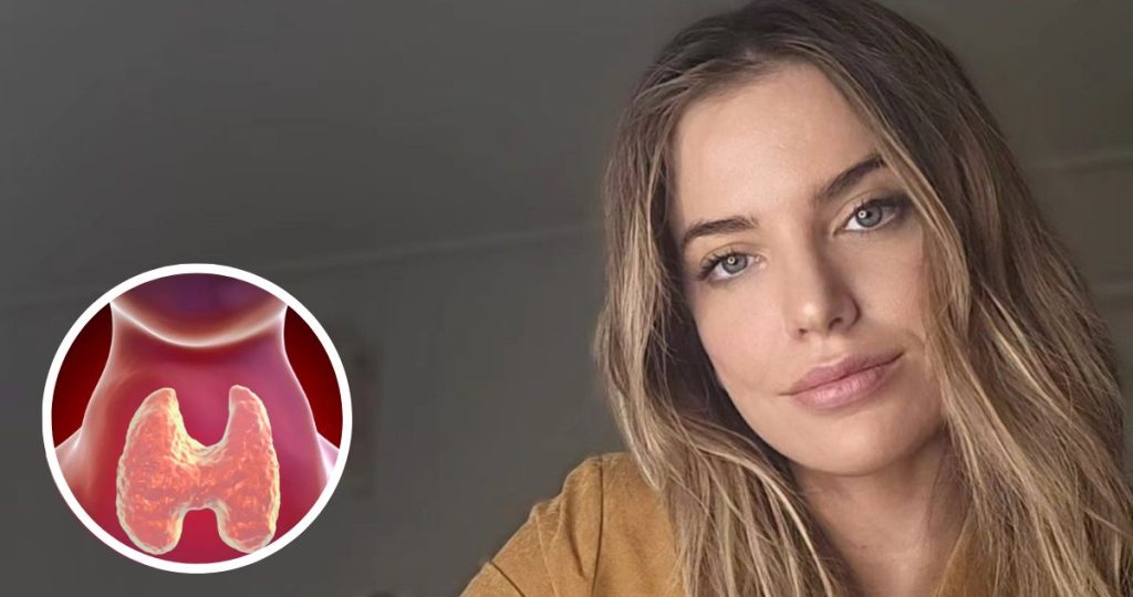 Millaray Viera revela su lucha contra el hipertiroidismo