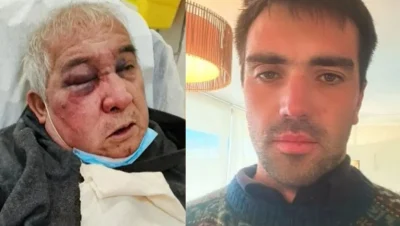 Conserje Agredido en Vitacura - Impactante Agresión a Conserje Deja Secuelas Graves en Vitacura