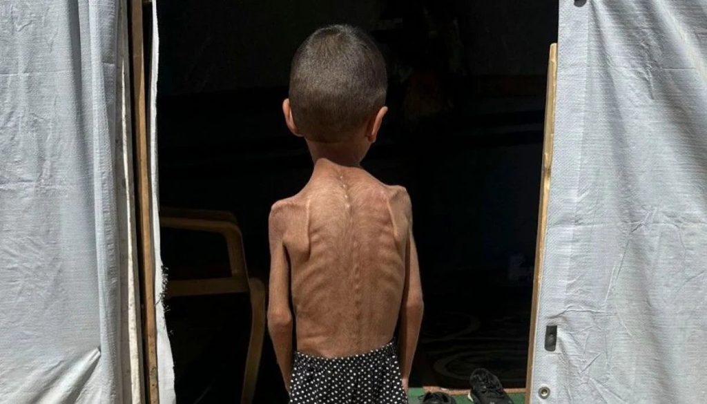 Muerte de Niños por Desnutrición en Gaza tras los Ataques de Israel - Crisis Humanitaria en Gaza: Niños Mueren por Desnutrición y Guerra
