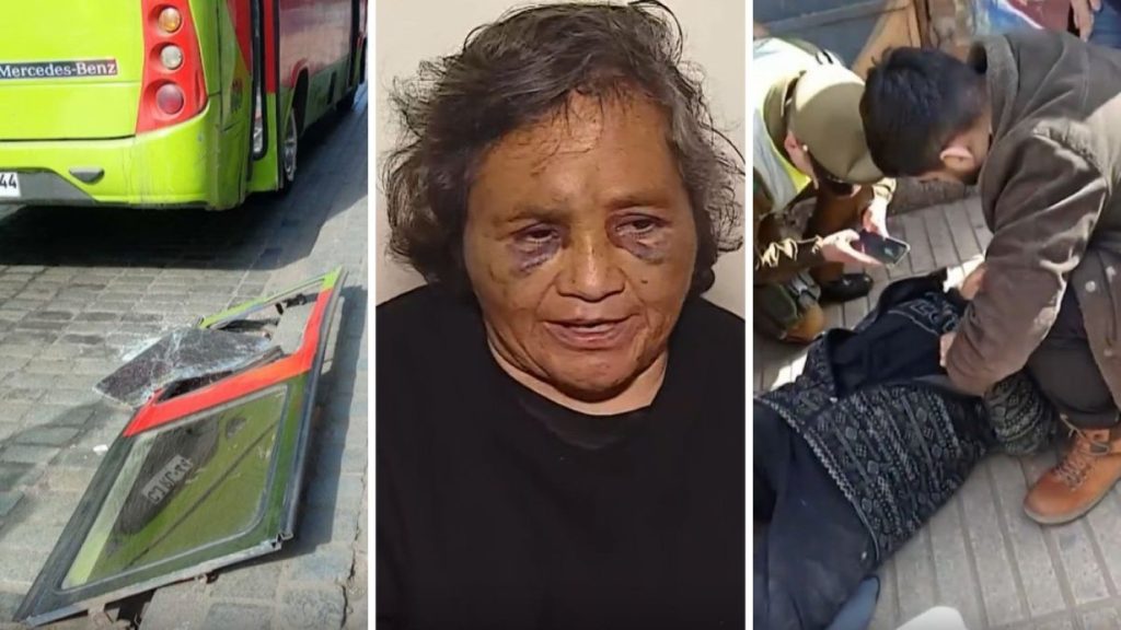 Mujer Golpeada por una Puerta Voladora de un Microbús en Valparaíso - Impactante Accidente: Puerta de Microbús Lesiona a Mujer en Valparaíso.