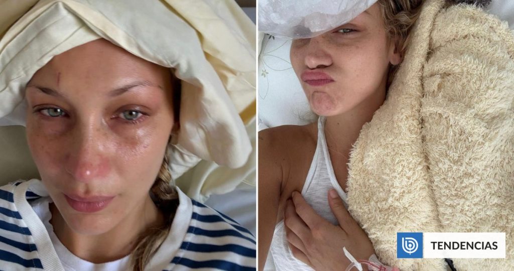Mensaje de Yolanda Hadid a Su Hija Bella, Hospitalizada por Lyme - Bella Hadid enfrenta valiente lucha contra la enfermedad de Lyme.