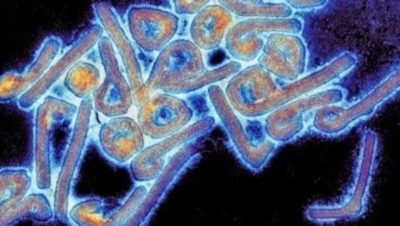 Brote del Virus de Marburgo en Etiopía - Brote del virus de Marburgo en Etiopía genera alarma sanitaria.